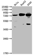 Fig.1 WB analysis of ZG-0755J. (Creative Biolabs Original)
