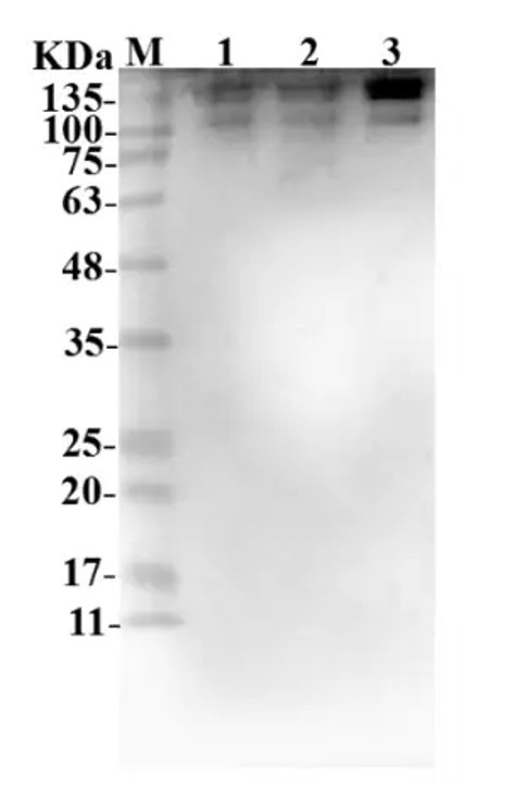 Fig.4 WB analysis. (Creative Biolabs Original)