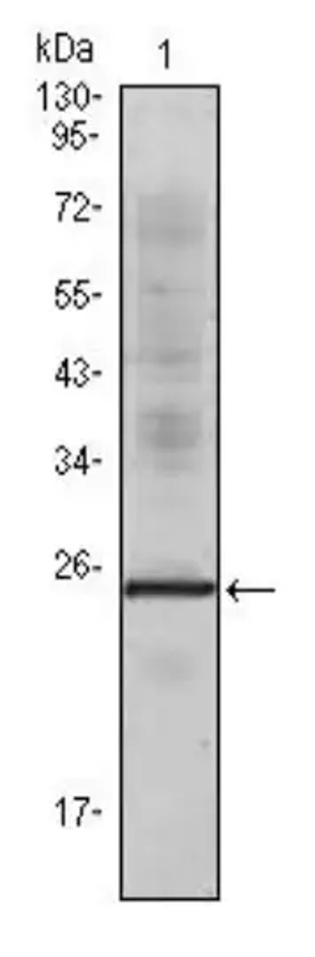 Fig.1 WB analysis. (Creative Biolabs Original)