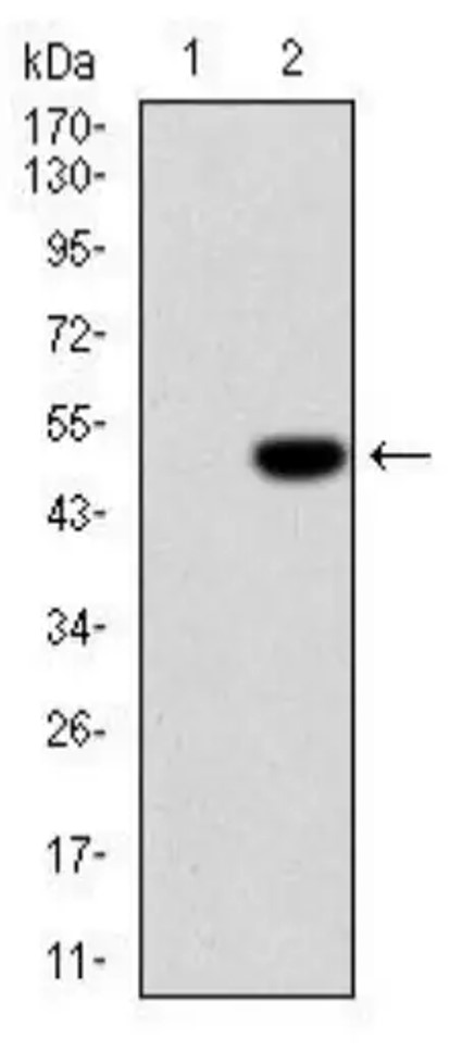 Fig.1 WB analysis. (Creative Biolabs Original)