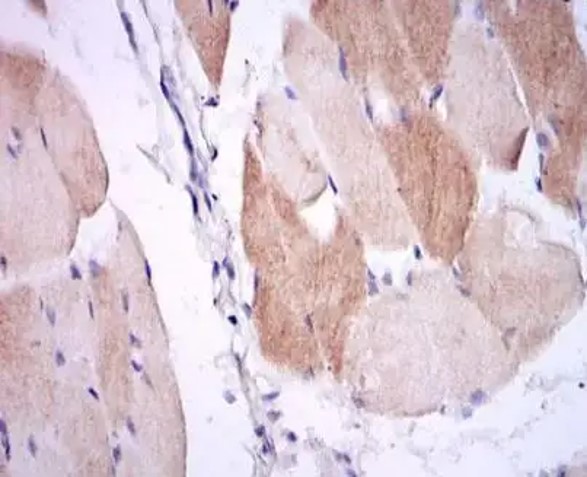 Fig.2 IHC analysis. (Creative Biolabs Original)