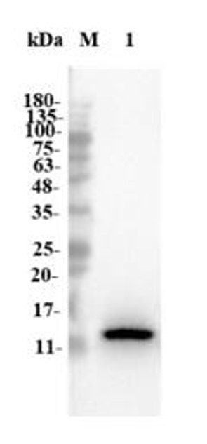 Fig.2 WB analysis. (Creative Biolabs Original)