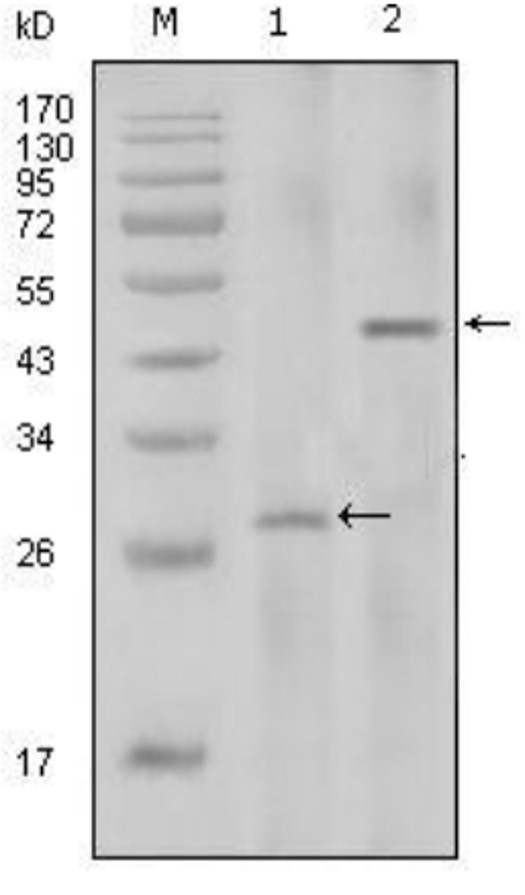 Fig.4 WB analysis. (Creative Biolabs Original)
