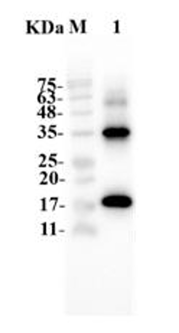 Fig.6 WB analysis. (Creative Biolabs Original)