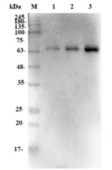 Fig.5 WB analysis. (Creative Biolabs Original)