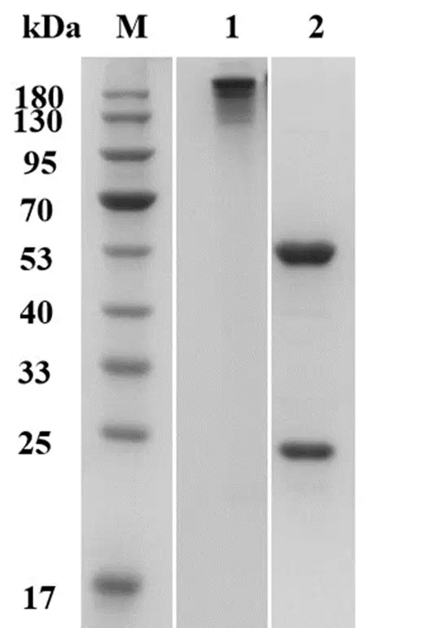 Fig.2 SDS-PAGE analysis. (Creative Biolabs Original)