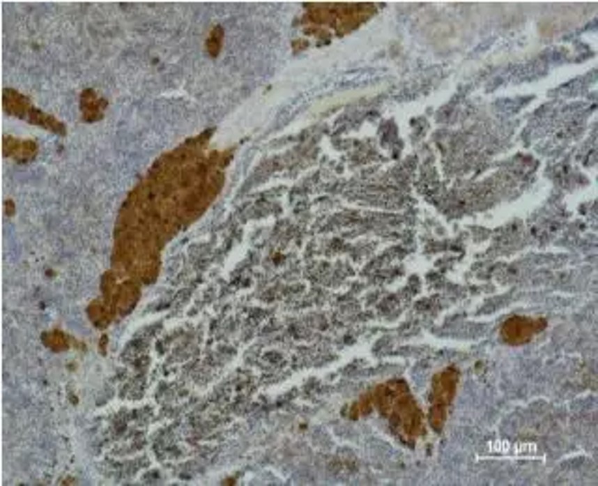 Fig.4 IHC analysis. (Creative Biolabs Original)