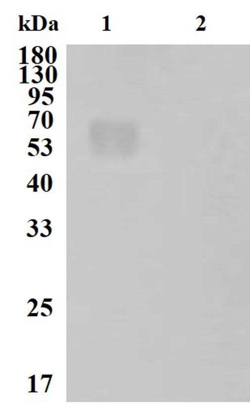 Fig.2 WB analysis. (Creative Biolabs Original)