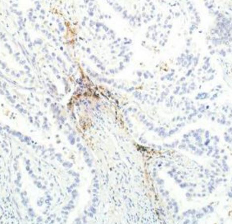 IHC analysis of MOB-0063F. (Creative Biolabs Original)