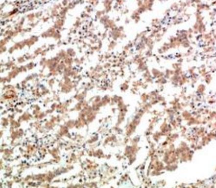 IHC analysis of MOB-0064F. (Creative Biolabs Original)