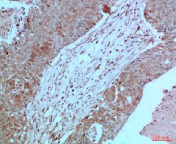 IHC analysis of MOB-0064F. (Creative Biolabs Original)