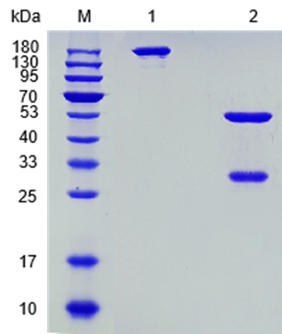 Fig.1 SDS-PAGE analysis. (Creative Biolabs Original)
