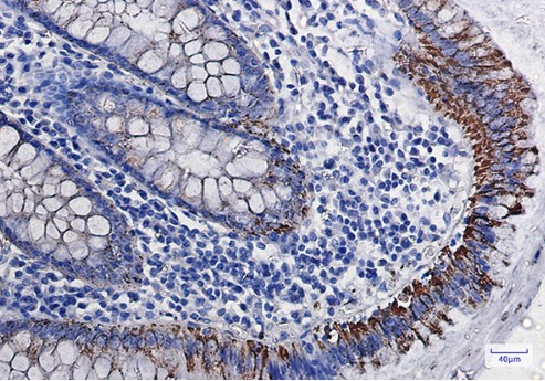 IHC analysis. (Creative Biolabs Original)