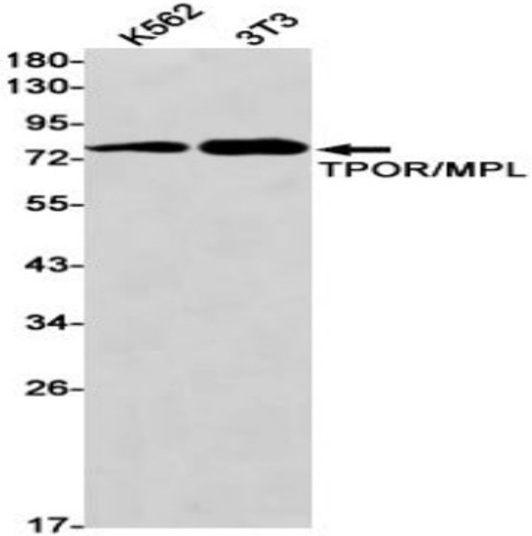 Fig.1 WB analysis. (Creative Biolabs Original)