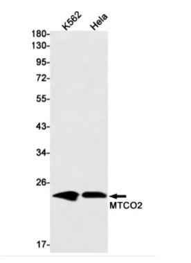 Fig.1 WB analysis. (Creative Biolabs Original)
