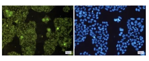 Fig.2 ICC analysis. (Creative Biolabs Original)