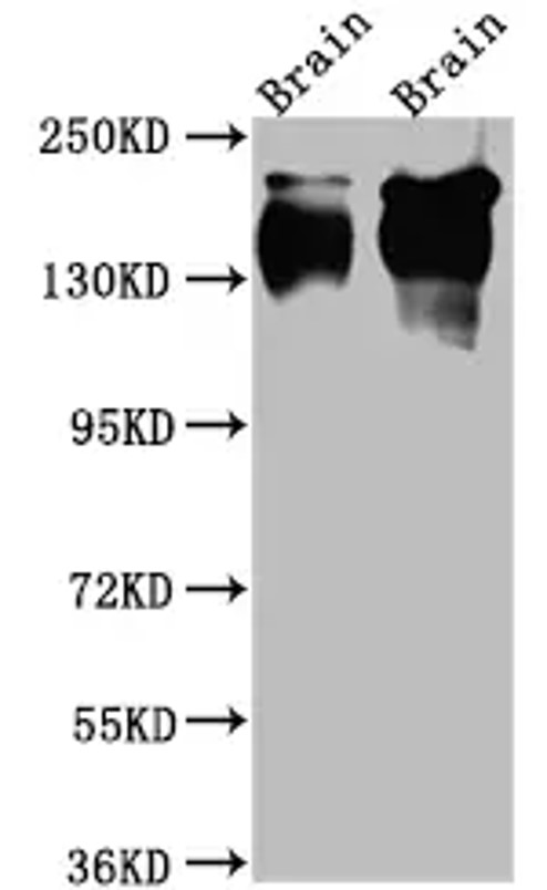 Fig.1 WB analysis. (Creative Biolabs Original)