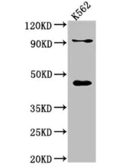 Fig.1 WB analysis. (Creative Biolabs Original)