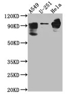 Fig.1 WB analysis of anti-PDE4D antibody. (Creative Biolabs Original)