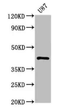 Fig.1 WB analysis. (Creative Biolabs Original)