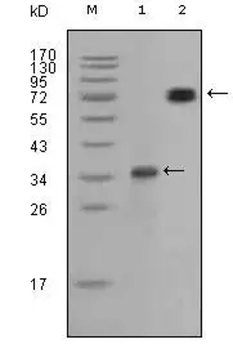 Fig.2 WB analysis. (Creative Biolabs Original)