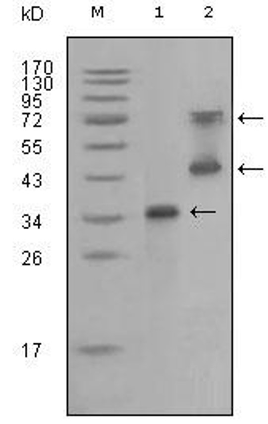 Fig.3 WB analysis. (Creative Biolabs Original)