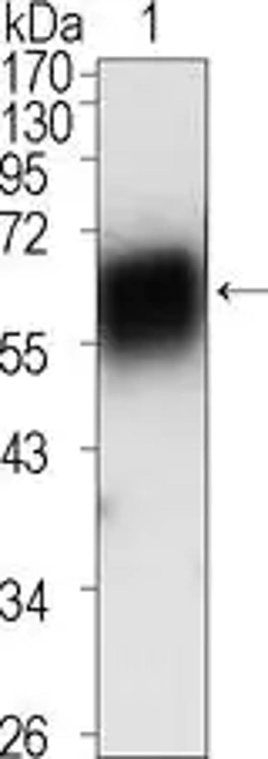 Fig.1 WB analysis. (Creative Biolabs Original)