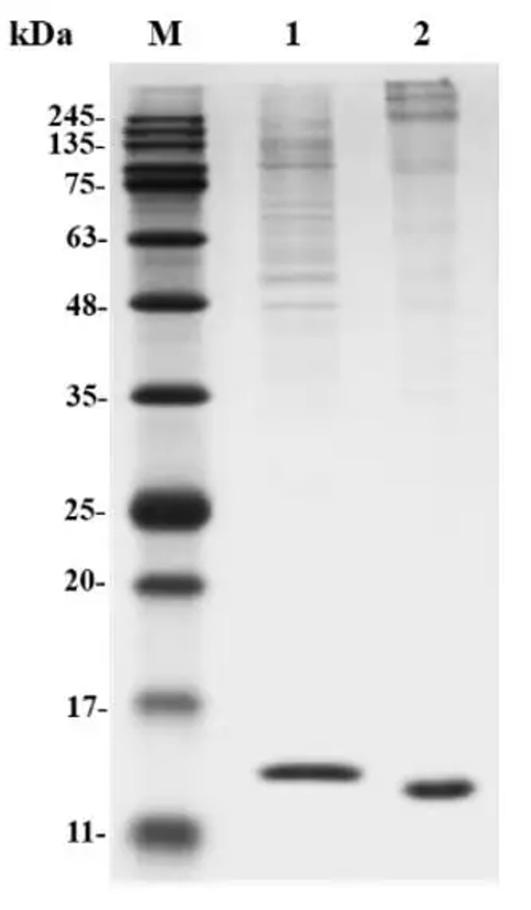 Fig.3 SDS-PAGE analysis. (Creative Biolabs Original)
