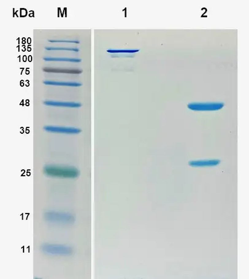 Fig.5 SDS-PAGE analysis. (Creative Biolabs Original)