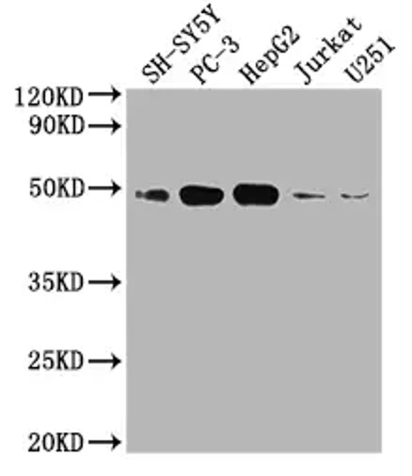 Fig.1 WB analysis. (Creative Biolabs Original)