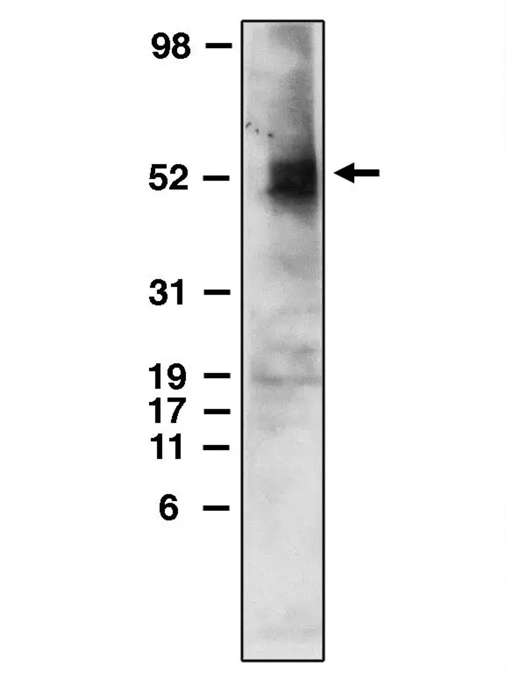Fig.1 WB analysis. (Creative Biolabs Original)