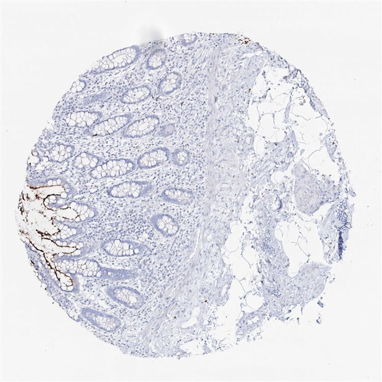 IHC analysis. (Creative Biolabs Original)