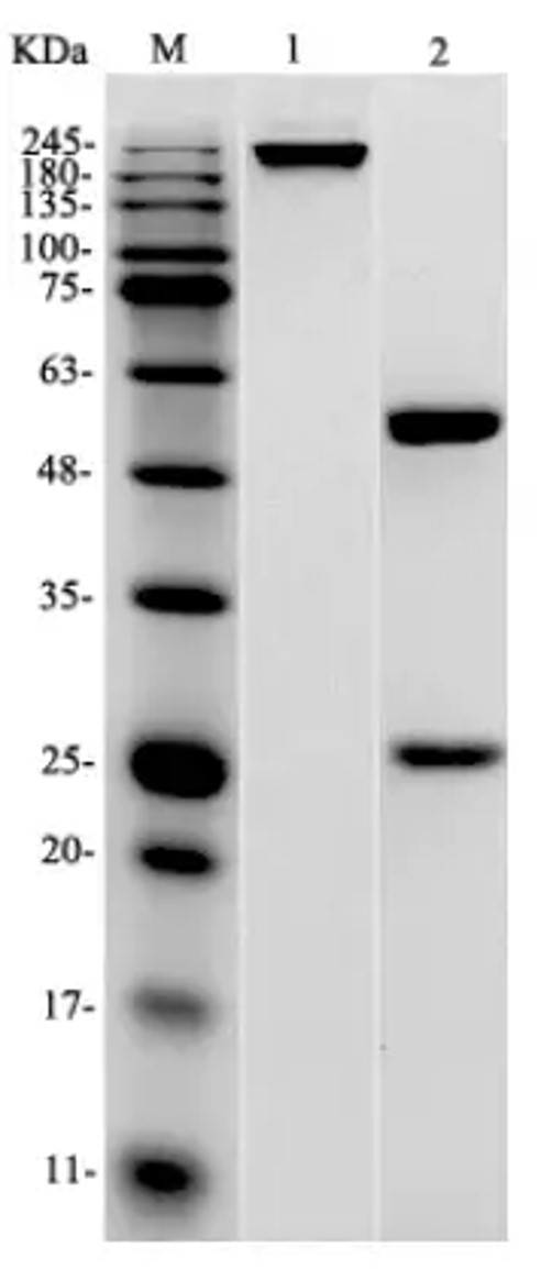 Fig.1 SDS-PAGE analysis. (Creative Biolabs Original)