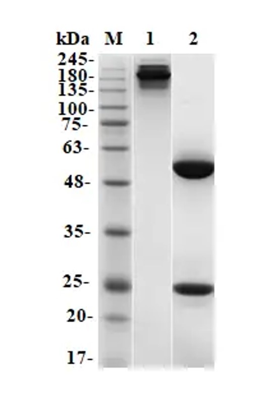 Fig.3 SDS-PAGE analysis. (Creative Biolabs Original)