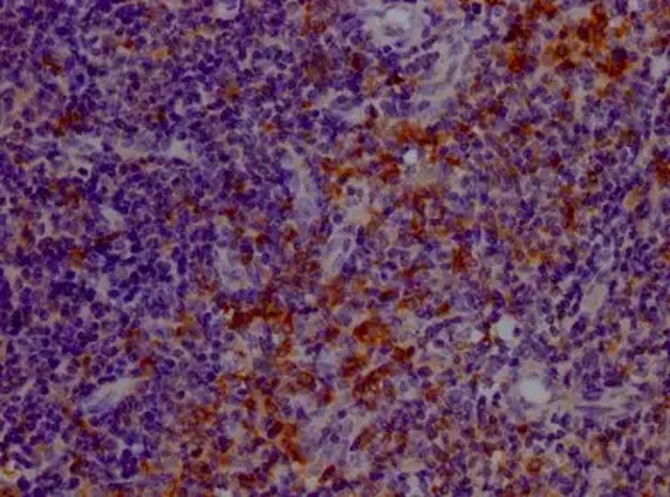 Fig.2 IHC analysis. (Creative Biolabs Original)