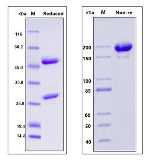 Fig.1 SDS-PAGE analysis. (Creative Biolabs Original)