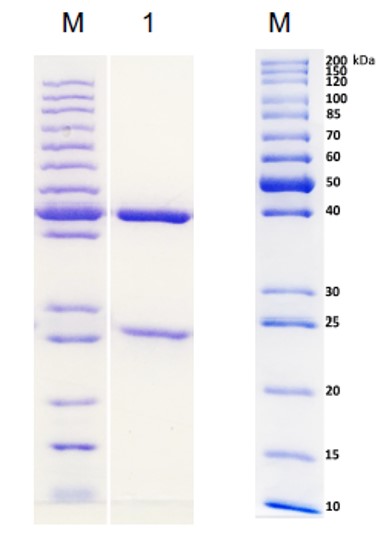 Fig.4 SDS-PAGE analysis. (Creative Biolabs Original)