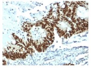 Fig.1 IHC analysis. (Creative Biolabs Original)