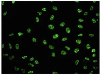 Fig.2 IF analysis. (Creative Biolabs Original)