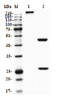 Fig.1 SDS-PAGE analysis. (Creative Biolabs Original)