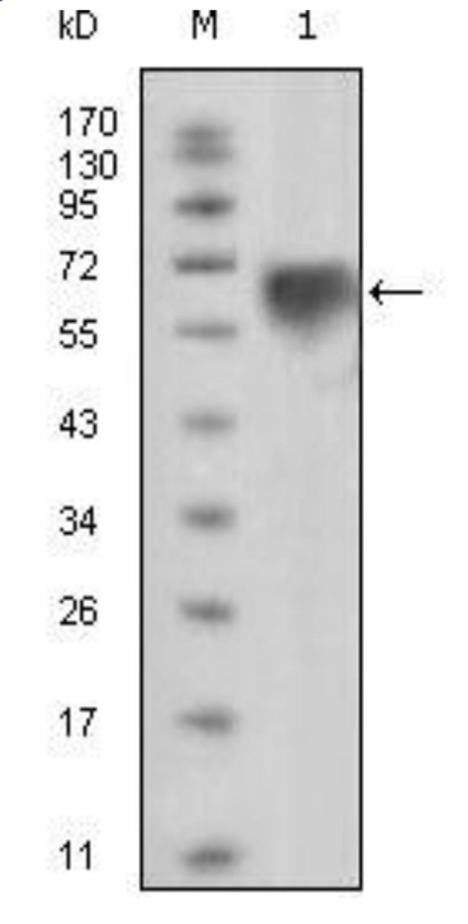 Fig.1 WB analysis. (Creative Biolabs Original)