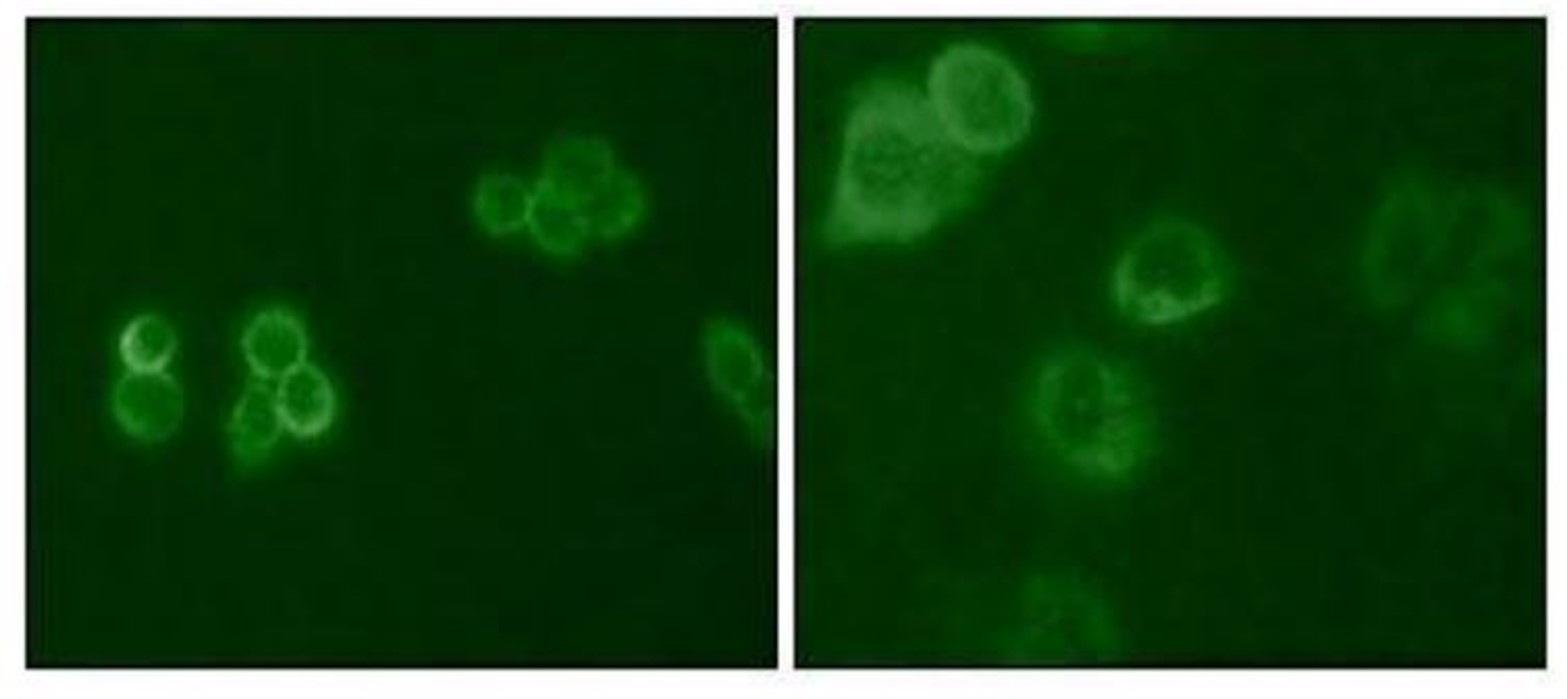 Fig.2 IF analysis. (Creative Biolabs Original)