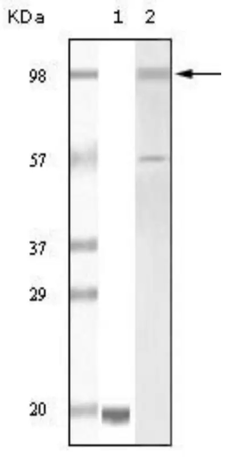 Fig.3 WB analysis. (Creative Biolabs Original)