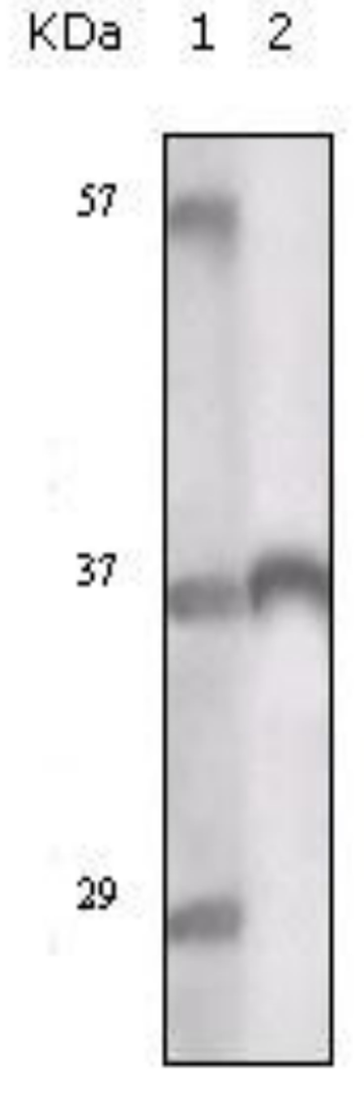 Fig.4 WB analysis. (Creative Biolabs Original)