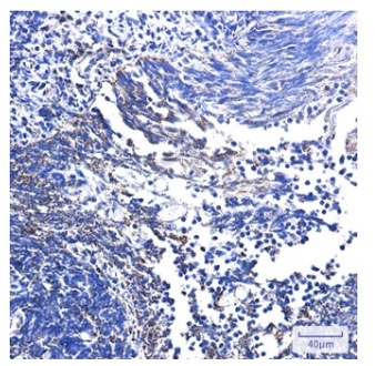 Fig.2 IHC analysis. (Creative Biolabs Original)