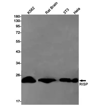 Fig.1 WB analysis. (Creative Biolabs Original)
