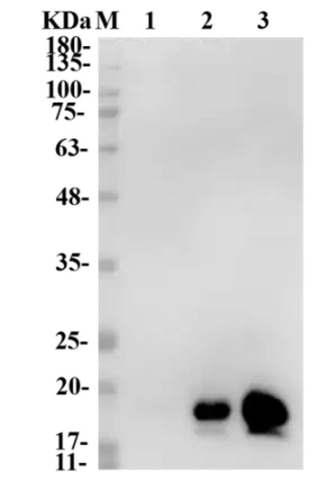 Fig.2 WB analysis. (Creative Biolabs Original)
