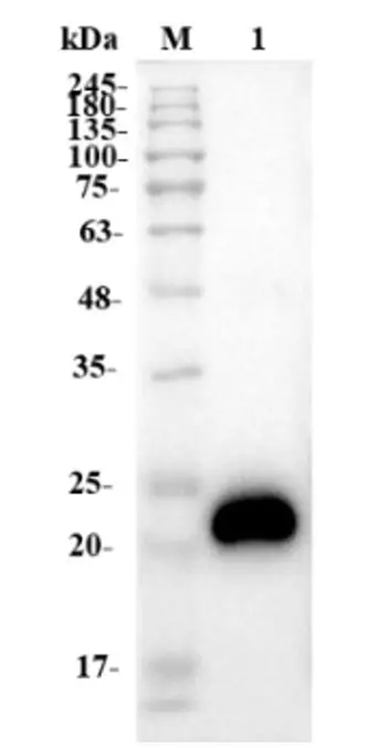 Fig.4 WB analysis. (Creative Biolabs Original)