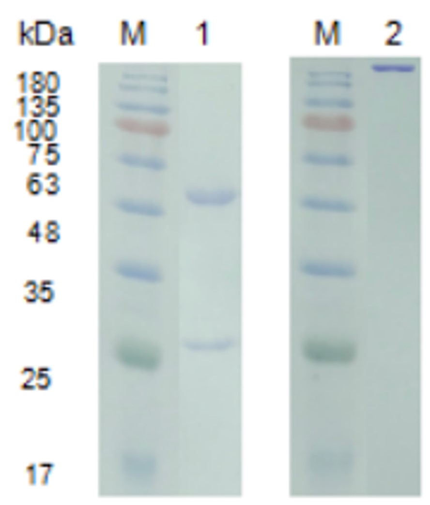 SDS-PAGE analysis. (Creative Biolabs Original)