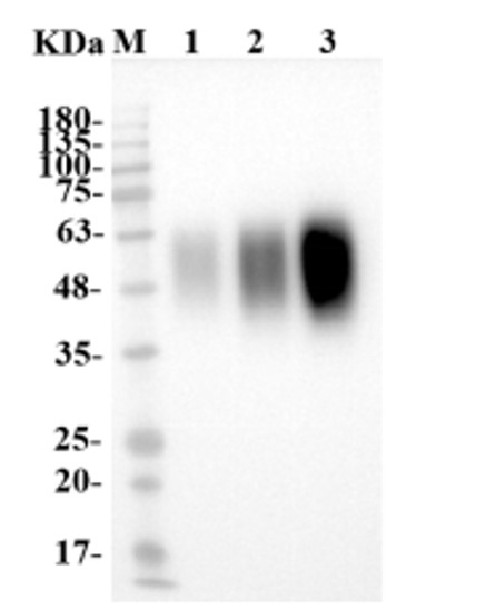 Fig.2 WB analysis. (Creative Biolabs Original)